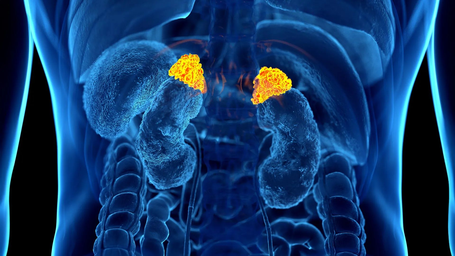 کشف بیومارکر استرس مزمن در اسکن CT با هوش مصنوعی